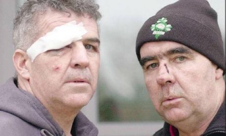 Injuries dished out by Gardai to Pat O'Donnell and his brother Martin