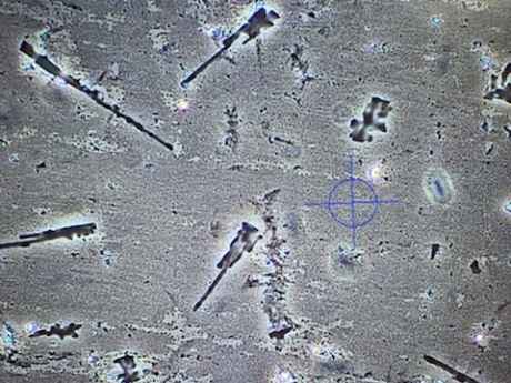 Pfizer booster (2) x 400 magnification,light microscopy -all images taken by me (Billy Ralph) personally.  What are these inclusions?